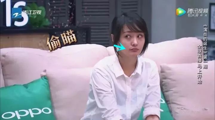 郑爽嘴角的疤痕疑似做嘴角上扬术?可微笑唇不是这样|郑爽|口角|baby_新浪女性_新浪网