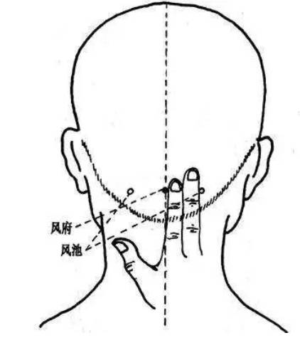 老年人口鼻出血_老年微信头像(3)