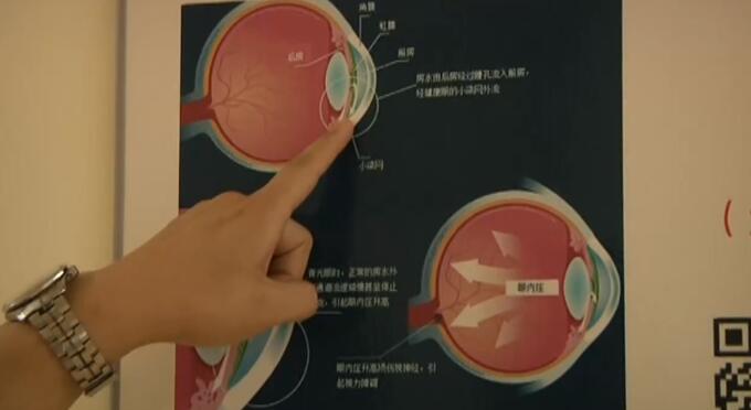 视频|慎用!男子为缓解疲劳用了半年眼药水 结果