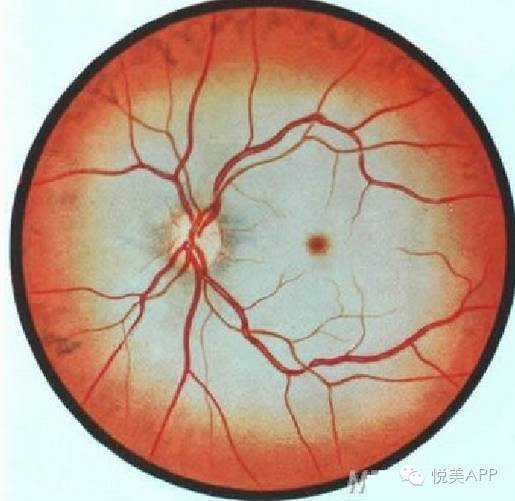 注射填充剂致失明?这事还得从源头说起.|填充剂