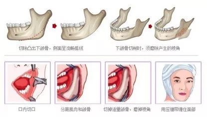 发型师:脸平脖子粗还想找我剪短发?不约!|斜方