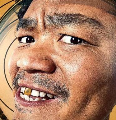 当心!24岁女子喝水喝出急性腰扭伤!这个病已经