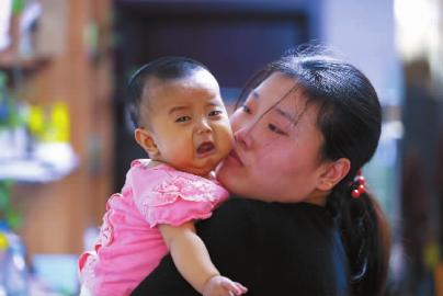 可恶的黄疸把可爱的她变成了绿眼睛糖糖|黄疸