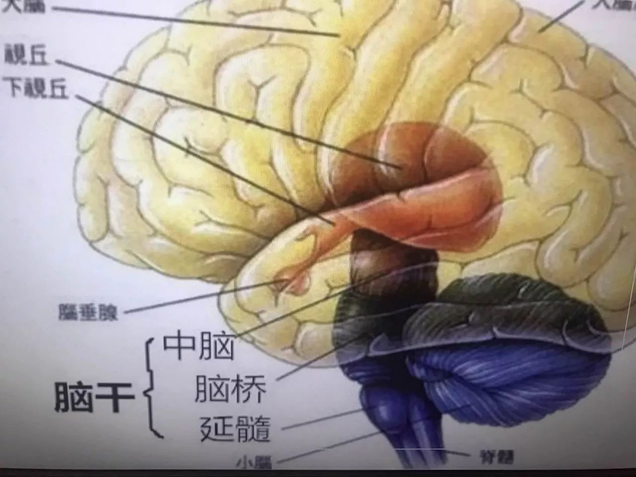哈尔滨男子脑干出血,昏迷近12小时!