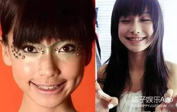 摘了牙套之后,14岁的杨颖长相是偏甜美系的.