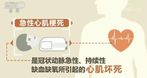 我国每年60万人患心梗 出现以下症状要及时就