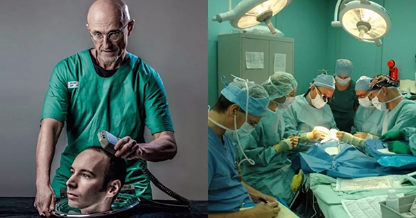 深观察|也谈换头术:如此"突破性"的实验为何要放到中国|换头术|头颅|伦理_新浪新闻