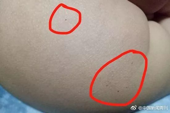 恶劣!北京朝阳区红黄蓝幼儿园被指对幼儿扎针