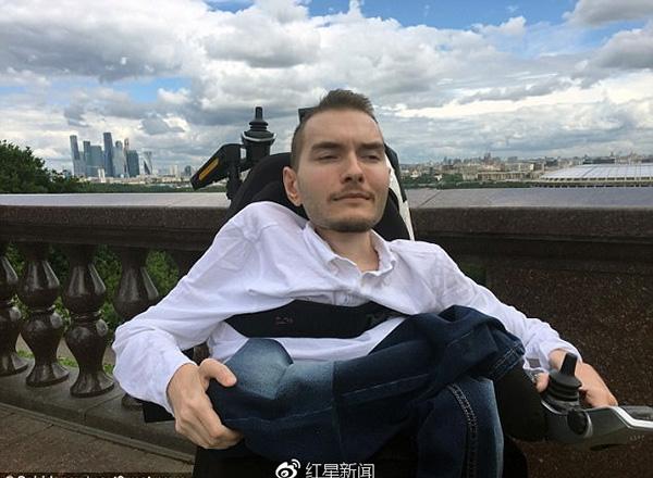 世界首位换头手术志愿者瓦列里&middot;斯皮里多诺夫