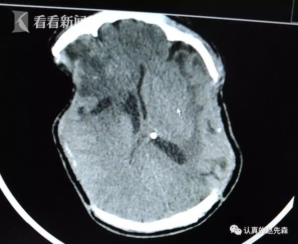 视频|父亲被撞成植物人两年多 肇事女司机买车