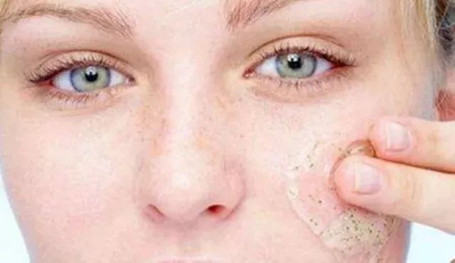 个误区,最后一个几乎人人都做错了!|油脂|皮肤瘙