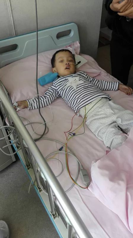 青岛小小三岁娃连做三次手术,差点丢了命!竟然