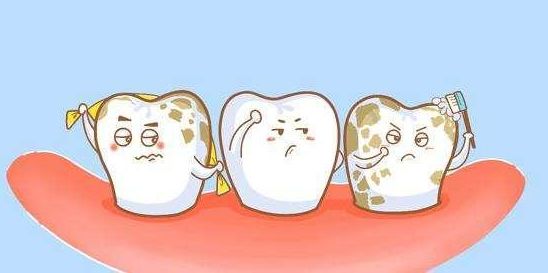 备受氟斑牙困扰?宁医大总院口腔医院招募50名