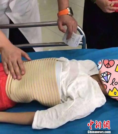 图为受伤儿童正在北京儿童医院接受治疗,目前无生命危险。受伤儿童家属供图