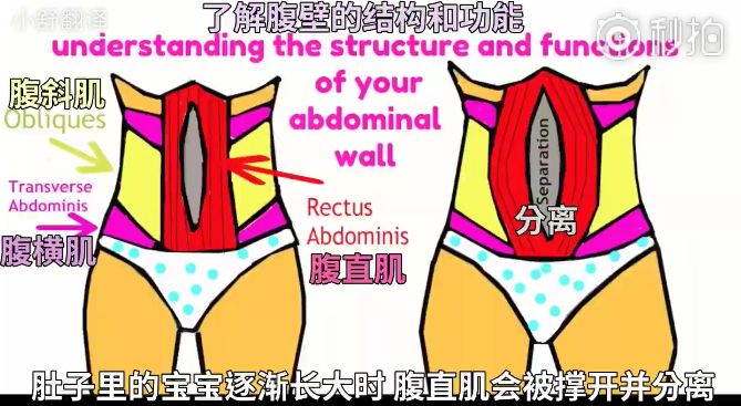 易舒美腹直肌修复仪和“束腹带”有什么区别？