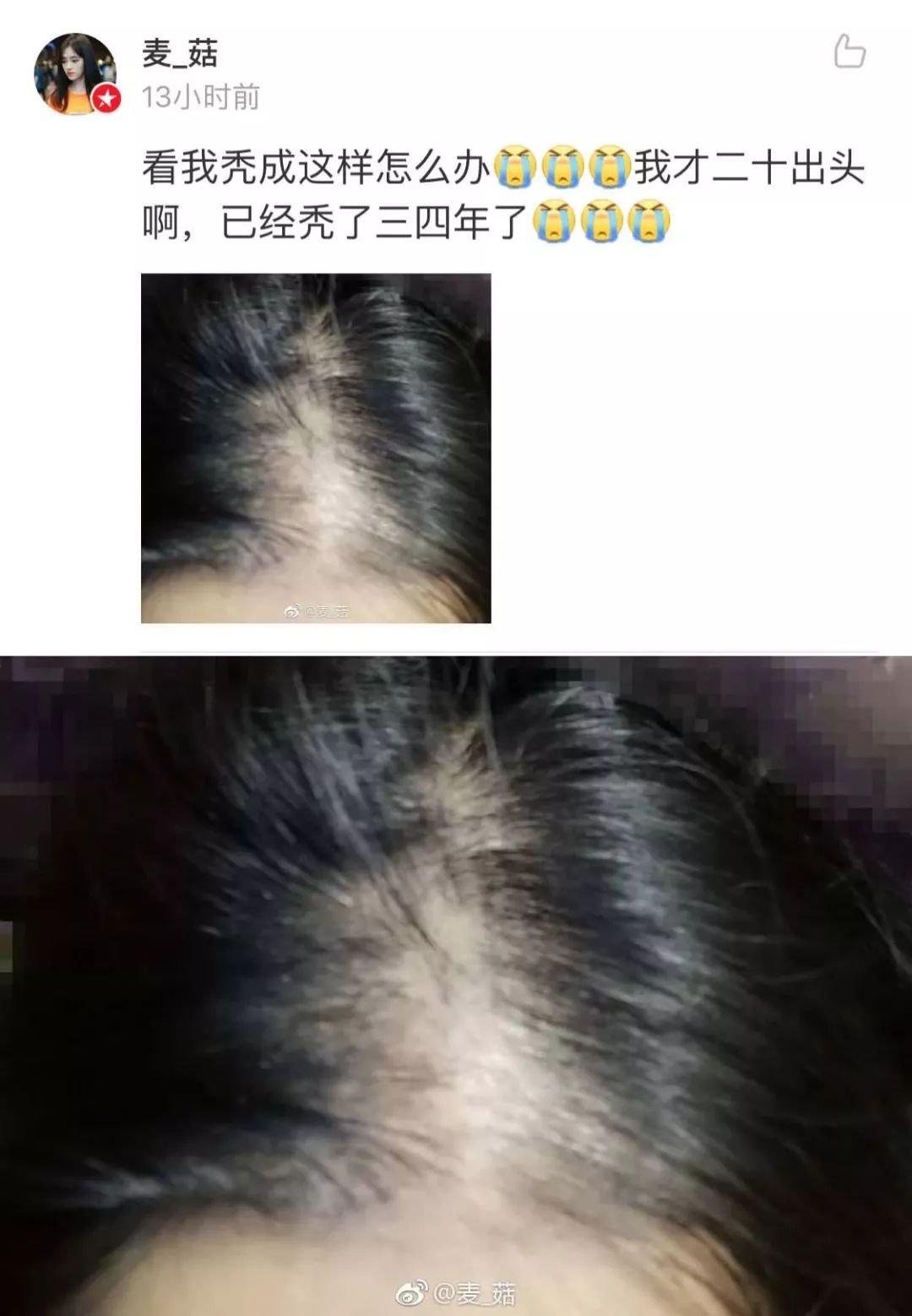 网友晒出脱发照,看得我头皮发麻!细思极恐!