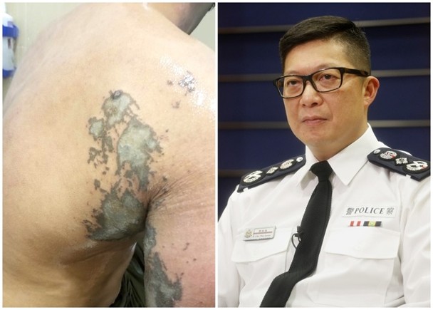 听到被淋强酸警察这句话 港警"一哥"鼻子一酸
