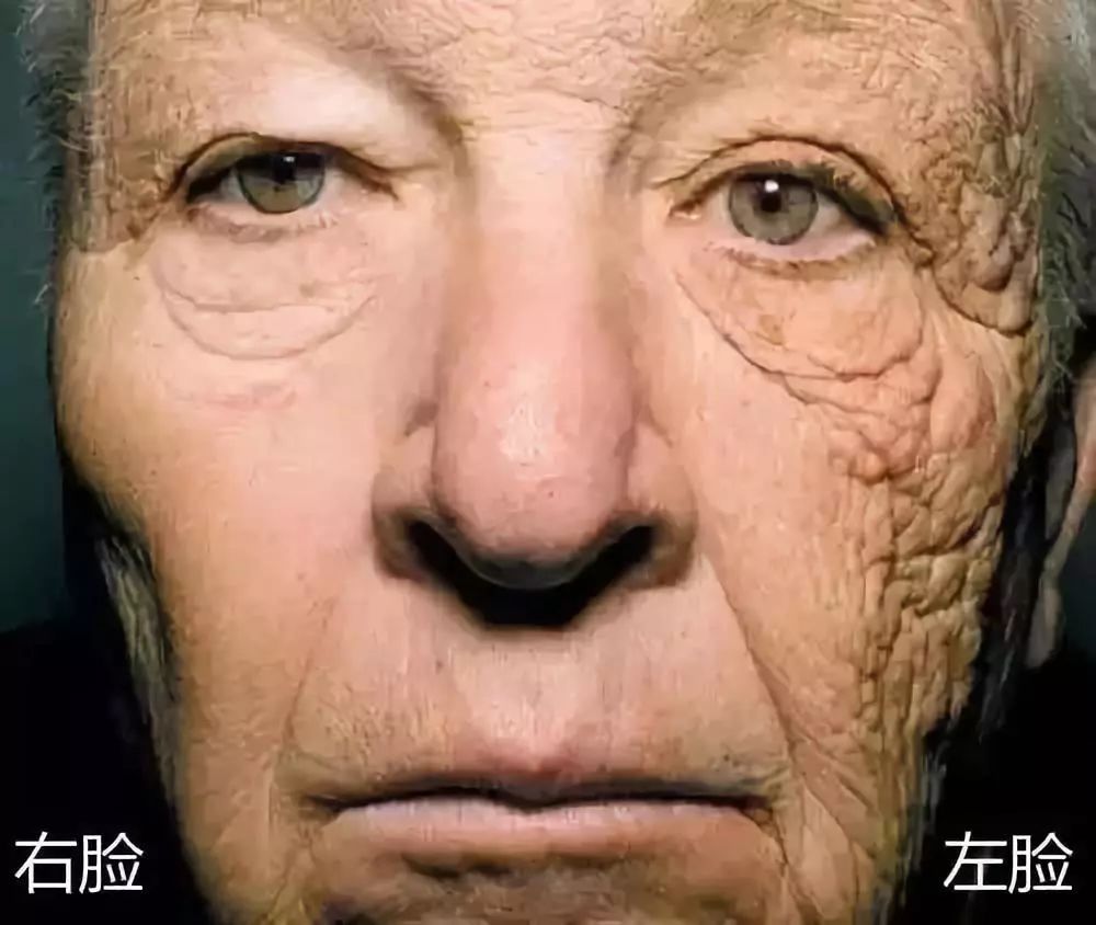 防晒只防紫外线,难怪你又晒黑了