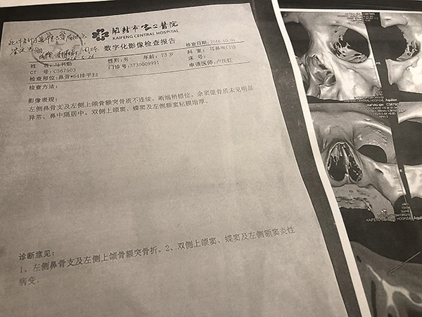 在重新鉴定中，四家医院的检查结果，都和开封市中心医院的检查结果不同。澎湃新闻记者 段彦超 图