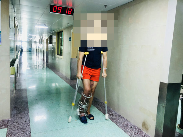 手術之后,“斷腿”的工人正在進行鍛煉。 法晚網 圖
