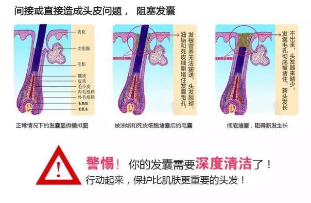 90%的女人都用错了洗发水，难怪头油、脱发！