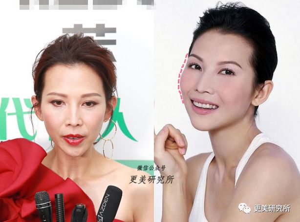 蔡少芬就属于高颧骨,不管是正面还是斜面,苹果肌都显得非常饱满.