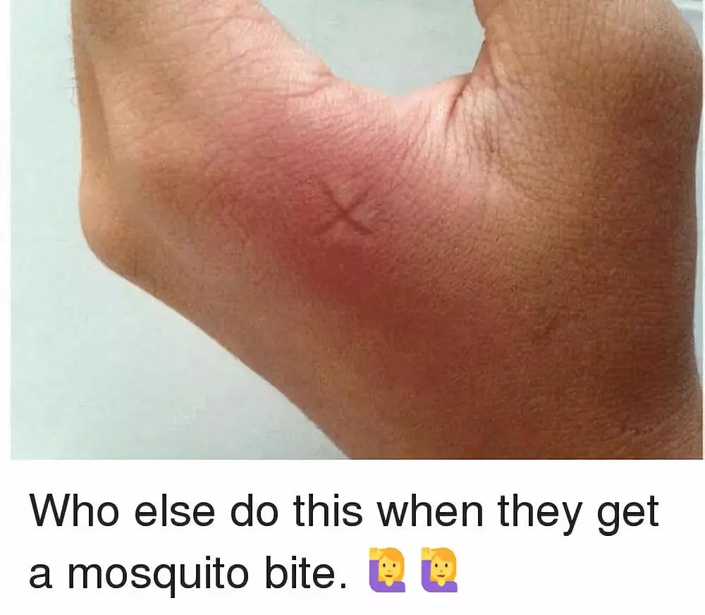 如何不被蚊子咬,尤其是在南方地区