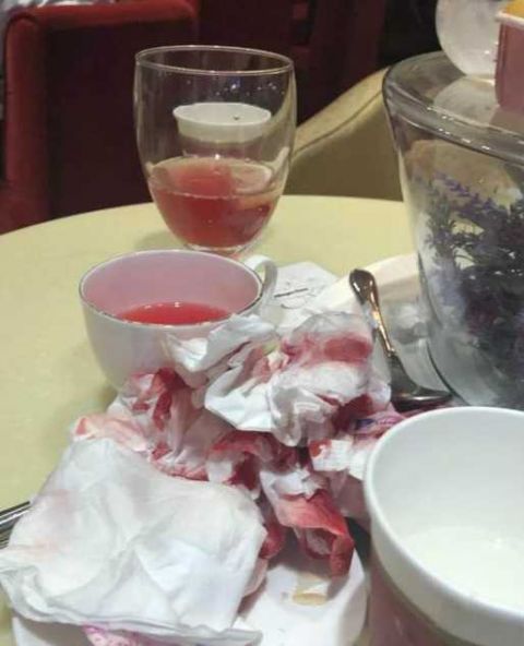 网友爆料在上海哈根达斯吃到疑似玻璃渣!满口是血!