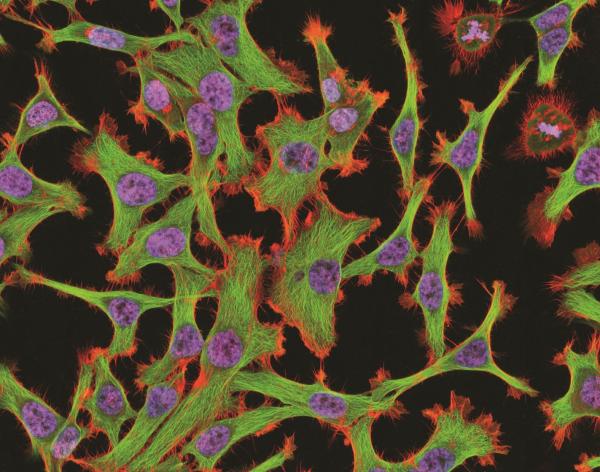 海拉细胞,揭开人体实验的黑历史与伦理审核的