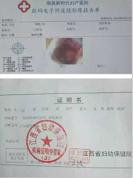 宫颈癌中晚期的这个信号,20-45岁女性一定要警惕!