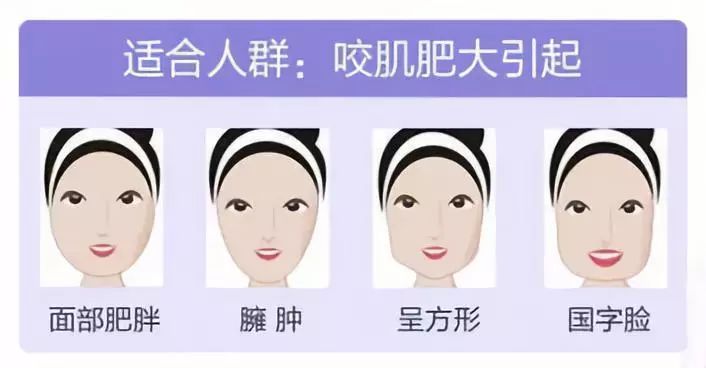 瘦脸针的人原理是什么_瘦脸针打了人变老了图