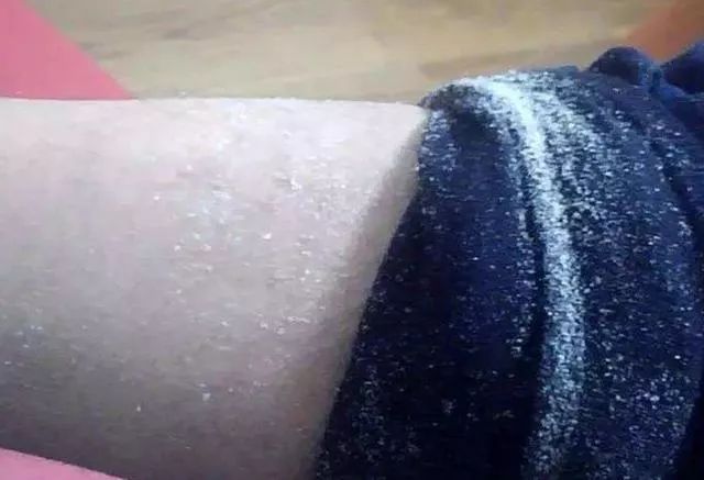 告别暗沉,脱皮,鸡皮肤……这只润肤露,平价大碗!