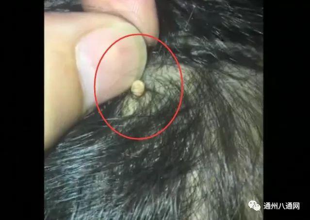 爸爸给女儿梳头,头皮上突现白"米粒",这东西你一定见着过