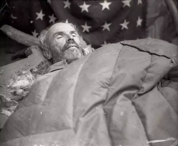 白求恩:在生命弥留之际仍不忘疟疾者和贫血病患者