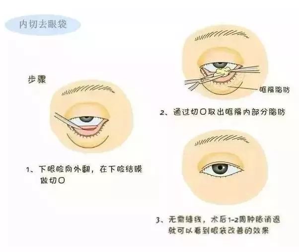 过程