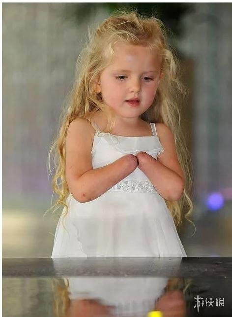 卡神这是一箭双雕啊!其团队为13岁女孩打造机械手臂