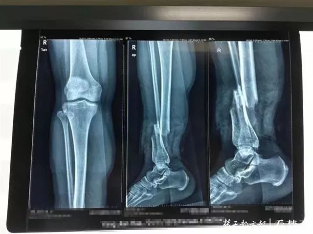 又出事 美女气枪专卖网在这种“网红桥”上被甩