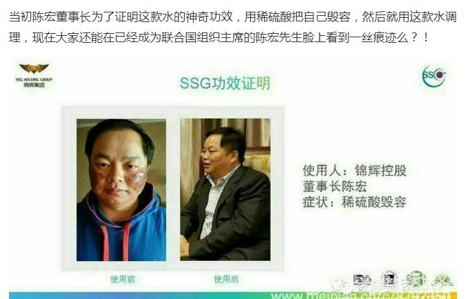 澳门银河076.com充值 - 艾玛倪妮因小雀斑魅力满格?做自己是为他们疯狂打call的原因