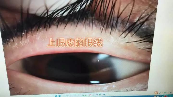 美女做了一条美瞳线后,每天都在遭罪……