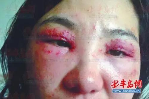 美容院卖的这东西千万别买,严重可致死亡!