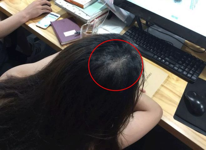 秋冬用它洗洗头,不出半月长出新发,浓密乌黑!皮皮虾的皮一下图片