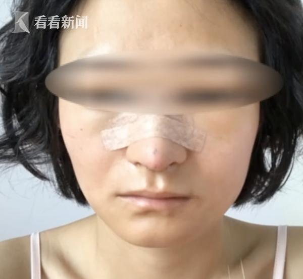 女主播花4万垫鼻不料变“匹诺曹” 开直播被网友怼：你想戳死谁