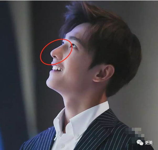 纯天然佟丽娅、混血郭碧婷鼻子竟然都透光,难道都是整的?