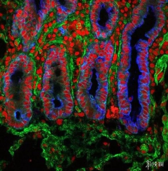 肌肉组织像无数根橡皮筋!显微镜下的人体竟是这样的