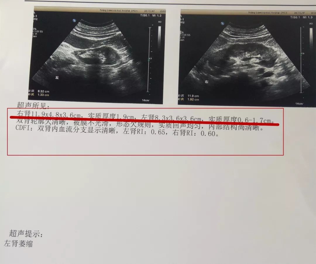医生您好，B超显示我早孕11周（9.9日检查），B超显示胎盘_产科_邻医网