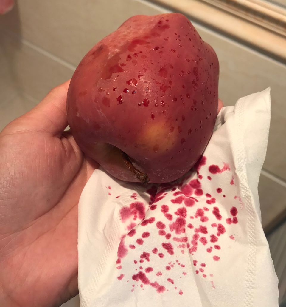 吓得我一愣一愣的!擦干净过后,又会冒出来红的……