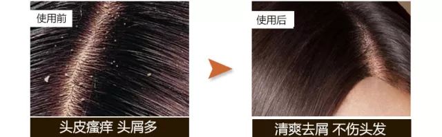 90%的女人都用错了洗发水，难怪头油、脱发！