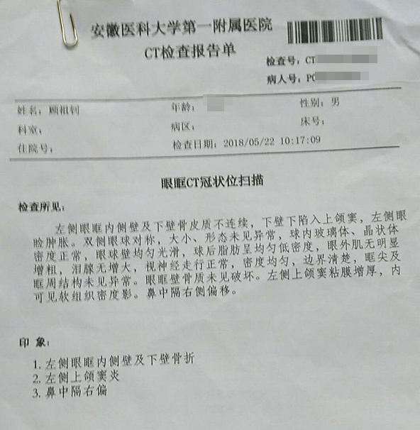 CT检查报告单