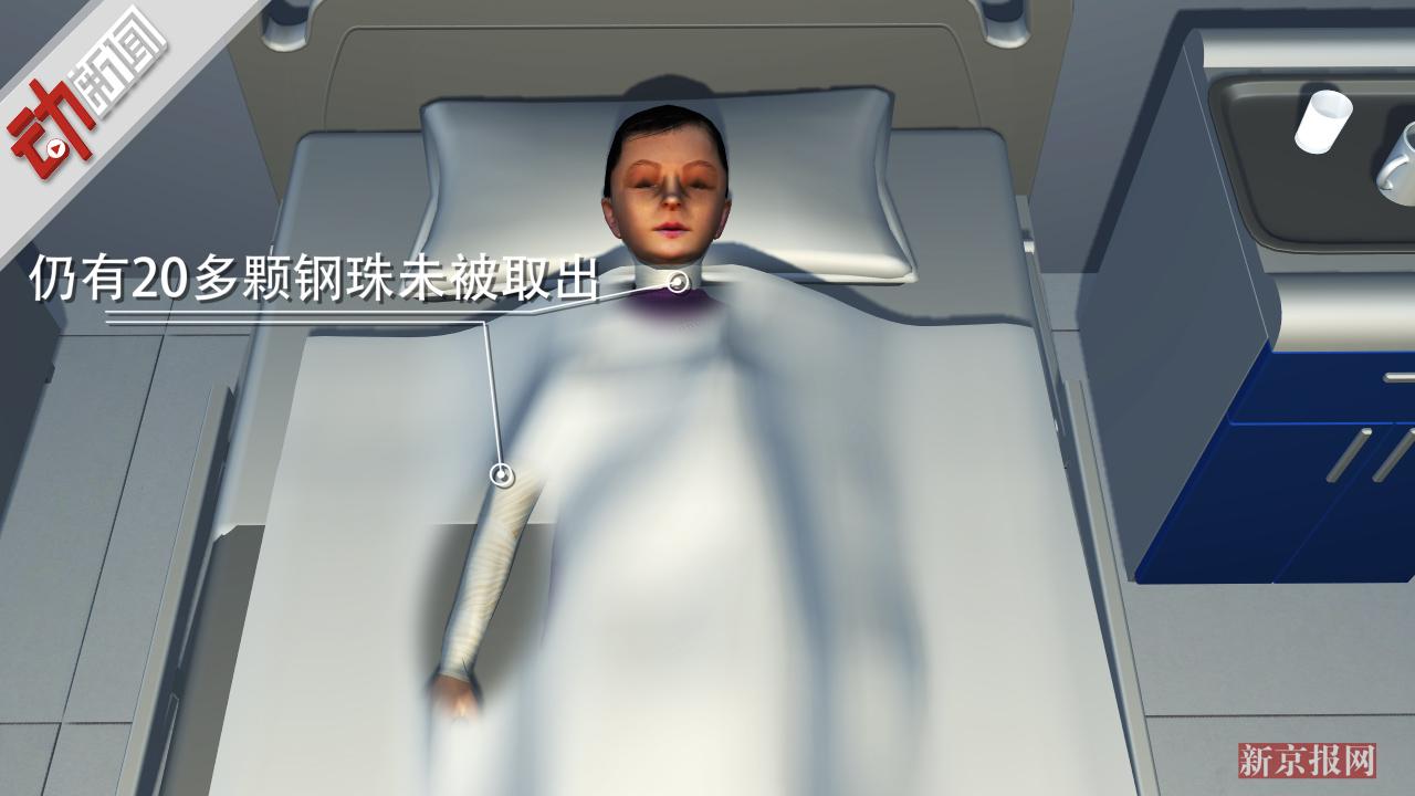 3D:打鸟霰弹枪当玩具 8岁男孩连扣扳机 11岁女