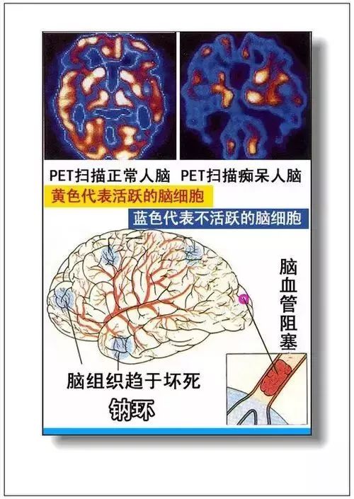 人体器官分部彩图及知识大全，太珍贵了！（建议收藏）